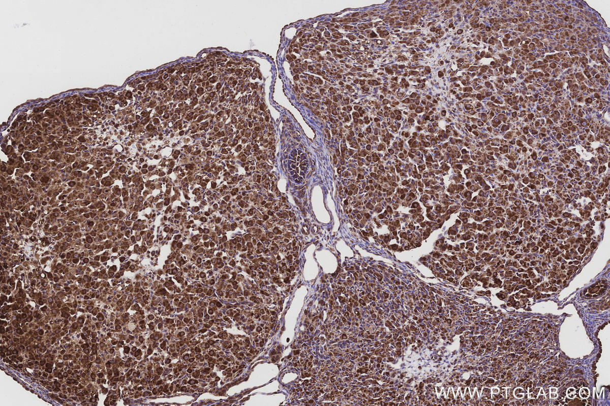Immunohistochemical analysis of paraffin-embedded rat ovary tissue slide using KHC3214 (GlnRS IHC Kit).