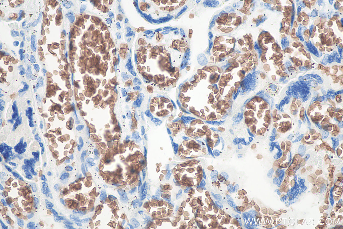 Immunohistochemical analysis of paraffin-embedded human placenta tissue slide using KHC0076 (Glycophorin A  IHC Kit).