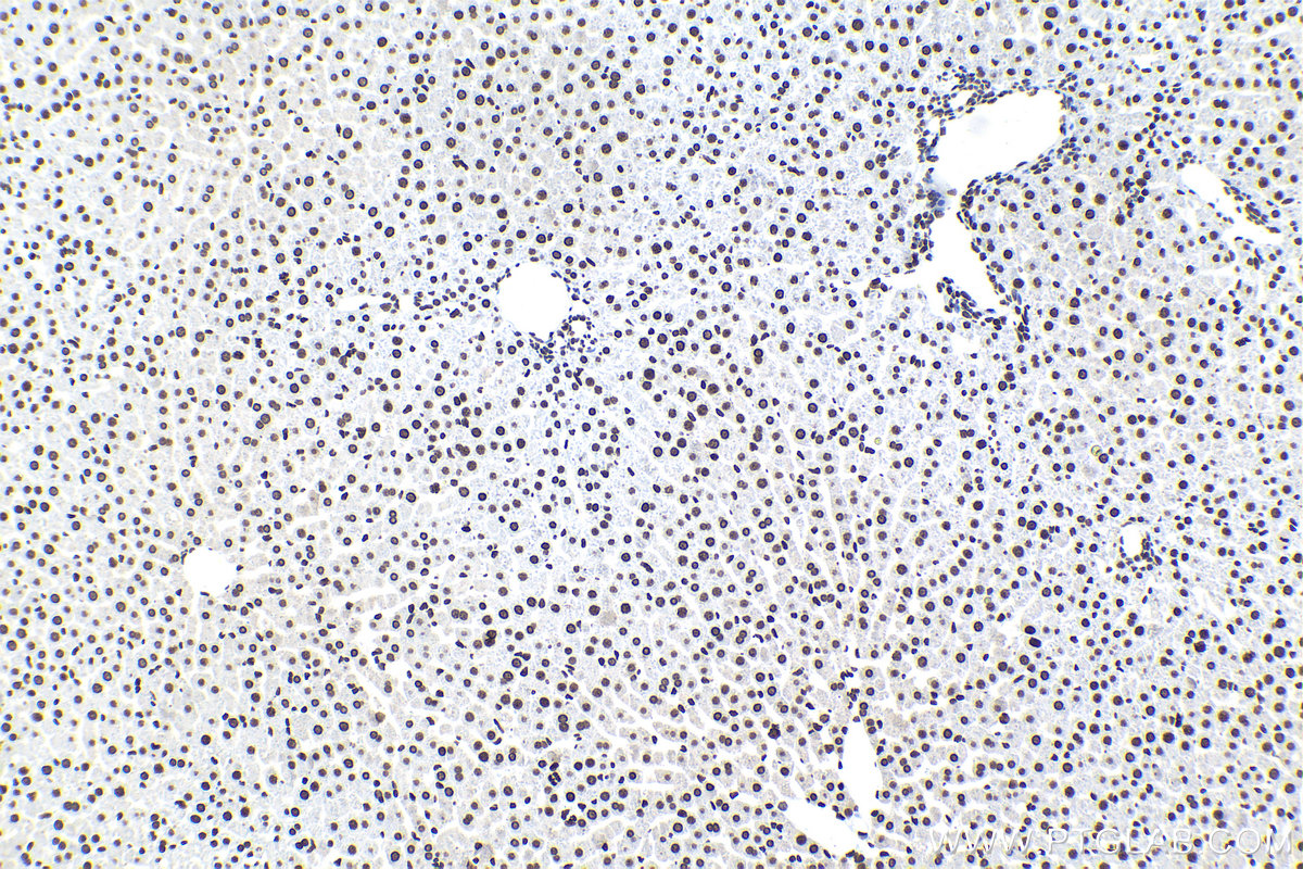 Immunohistochemical analysis of paraffin-embedded rat liver tissue slide using KHC1551 (H2AX IHC Kit).