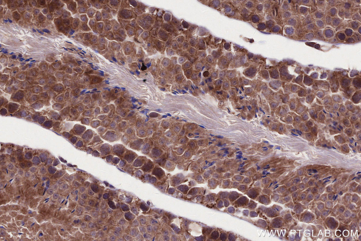 Immunohistochemical analysis of paraffin-embedded mouse testis tissue slide using KHC2661 (HACE1 IHC Kit).
