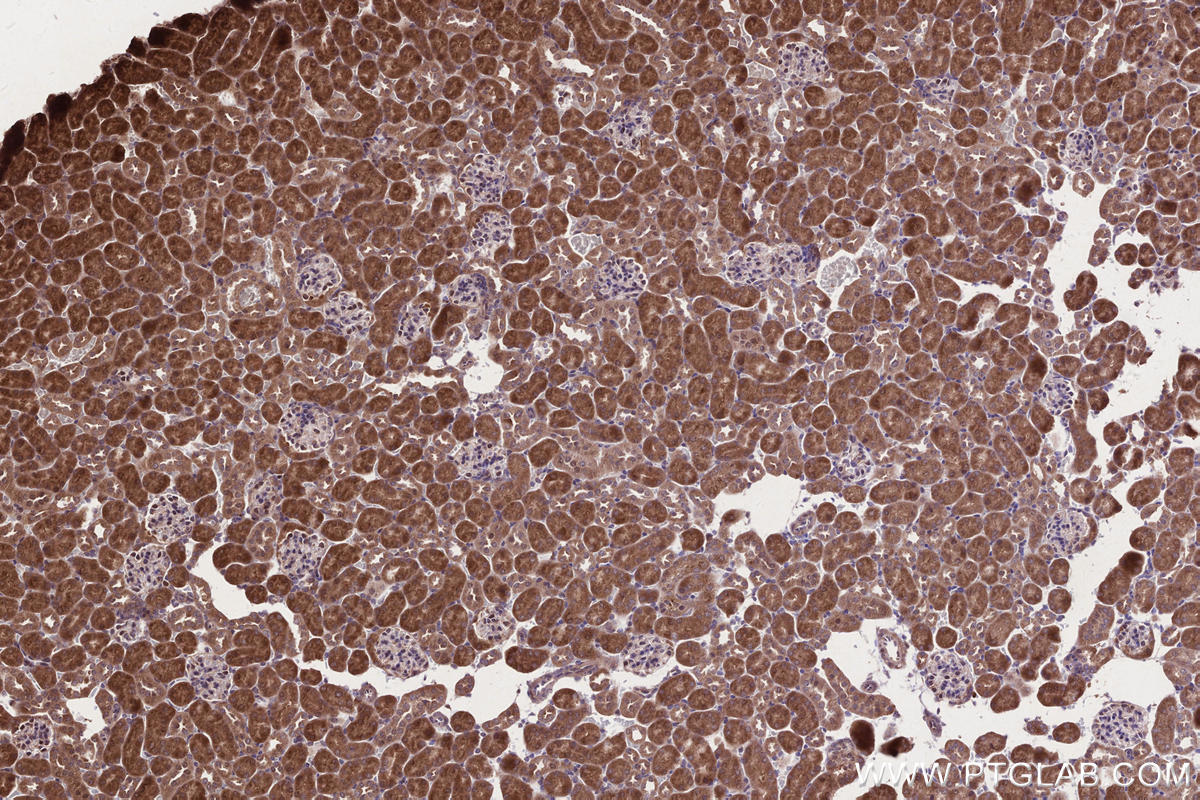 Immunohistochemical analysis of paraffin-embedded mouse kidney tissue slide using KHC2661 (HACE1 IHC Kit).