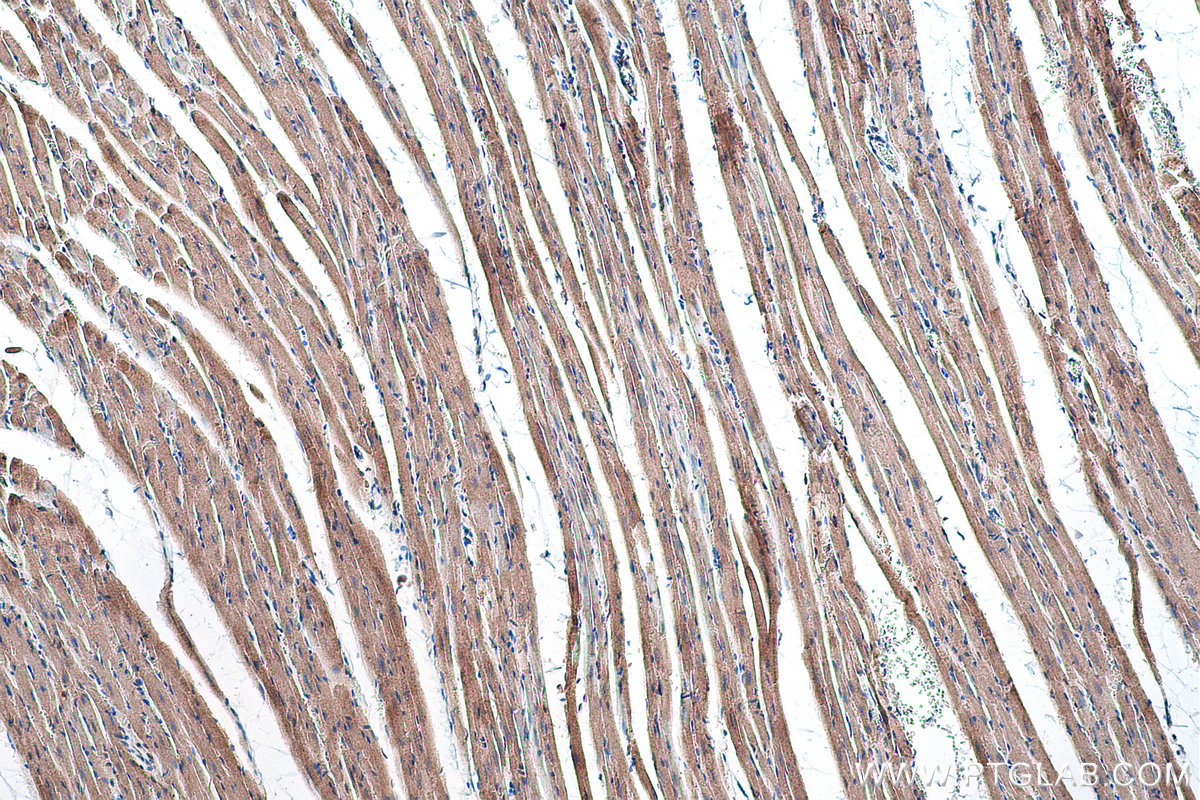 Immunohistochemical analysis of paraffin-embedded rat heart tissue slide using KHC0553 (HADHA IHC Kit).