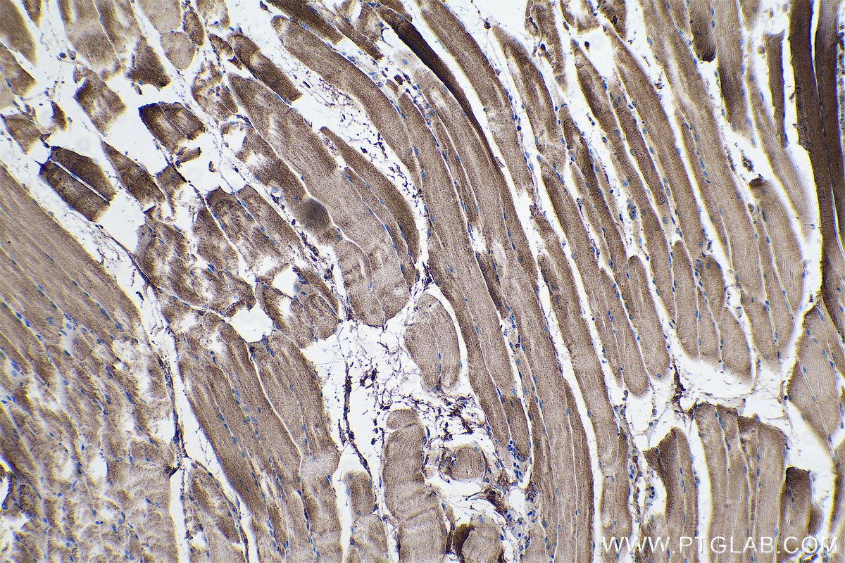 Immunohistochemical analysis of paraffin-embedded mouse skeletal muscle tissue slide using KHC0554 (HADHB IHC Kit).