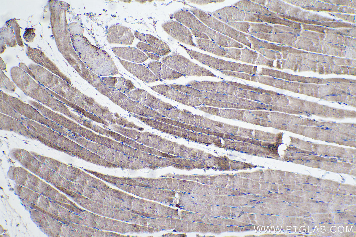 Immunohistochemical analysis of paraffin-embedded rat skeletal muscle tissue slide using KHC0554 (HADHB IHC Kit).