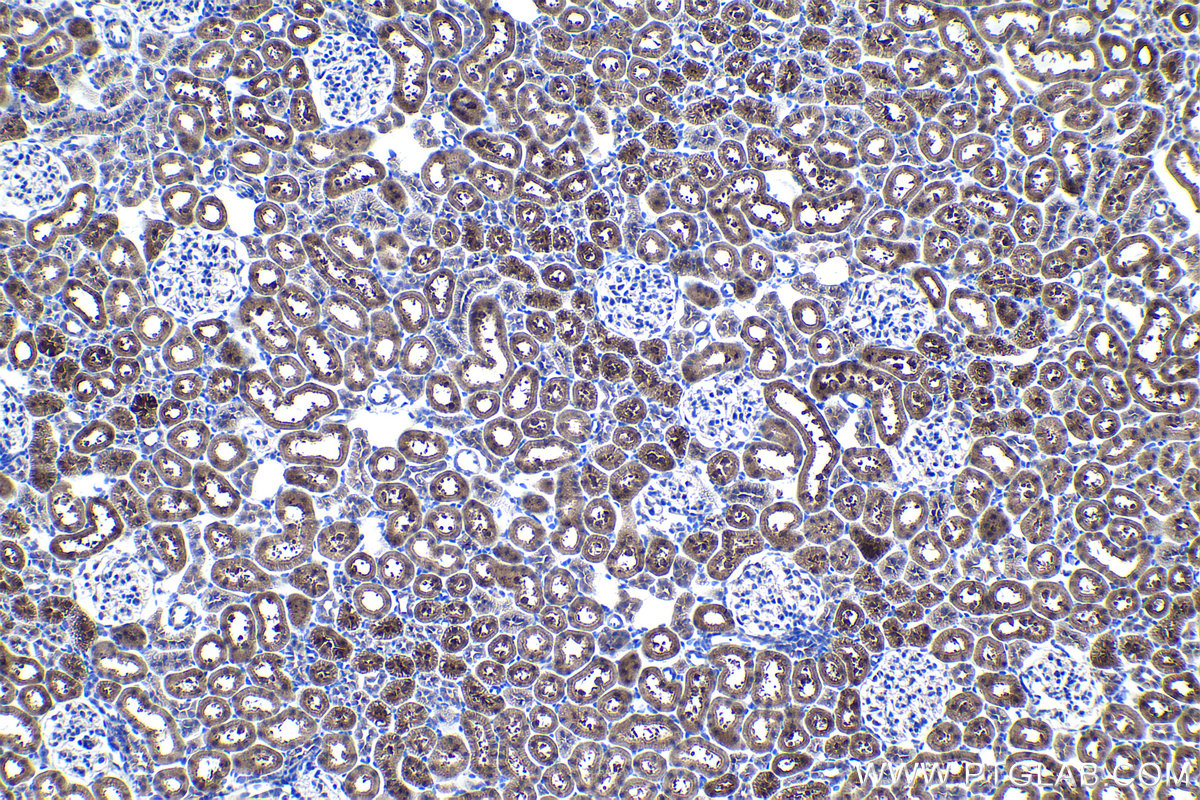 Immunohistochemical analysis of paraffin-embedded rat kidney tissue slide using KHC1047 (HAGH IHC Kit).