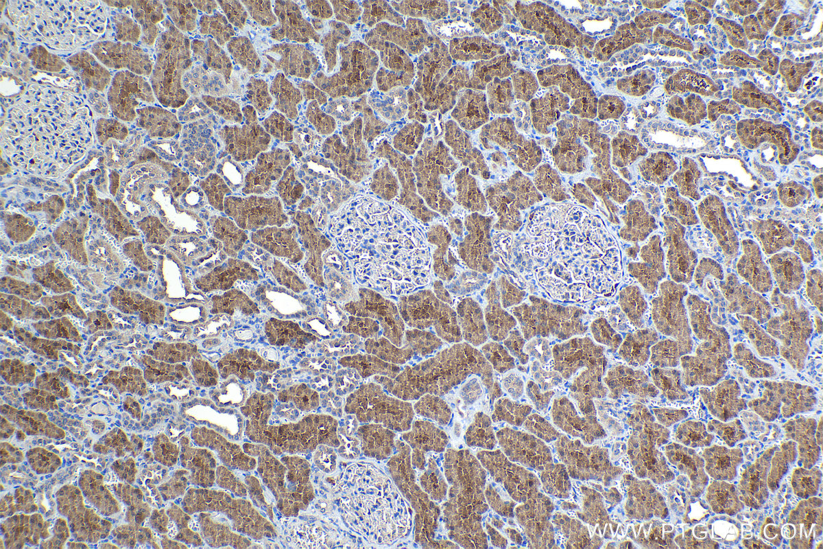 Immunohistochemical analysis of paraffin-embedded human kidney tissue slide using KHC1047 (HAGH IHC Kit).