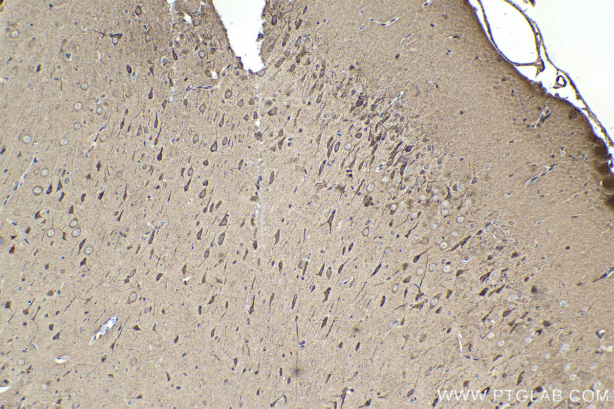 Immunohistochemical analysis of paraffin-embedded rat brain tissue slide using KHC1627 (HAP1 IHC Kit).