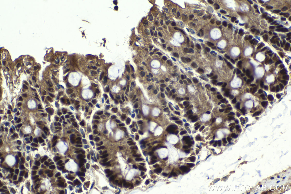 Immunohistochemical analysis of paraffin-embedded mouse intestine tissue slide using KHC2062 (HAT1 IHC Kit).