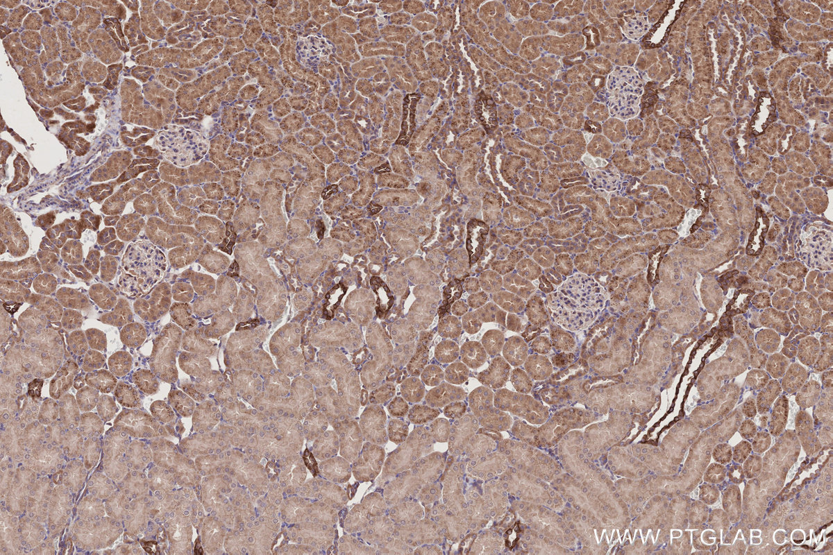 Immunohistochemical analysis of paraffin-embedded rat kidney tissue slide using KHC2782 (HAUS1 IHC Kit).