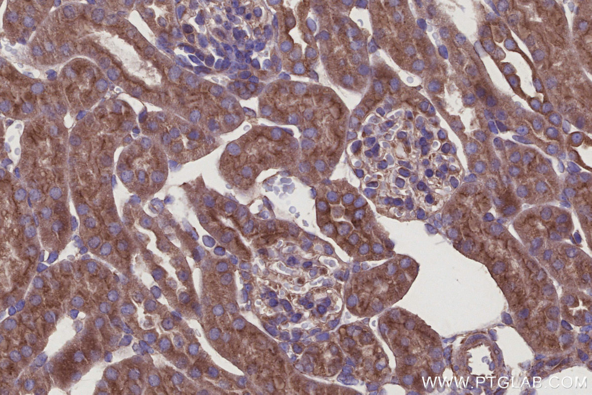 Immunohistochemical analysis of paraffin-embedded mouse kidney tissue slide using KHC2918 (HAUS4 IHC Kit).
