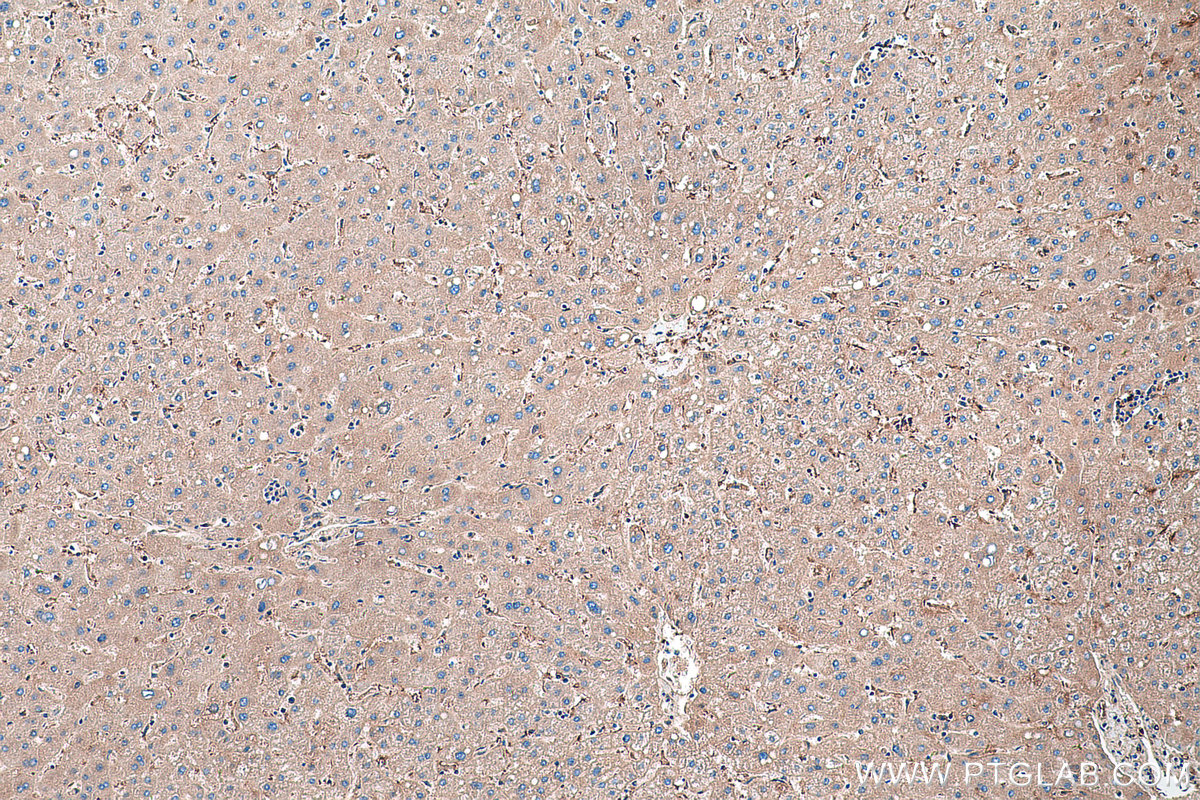 Immunohistochemical analysis of paraffin-embedded human liver tissue slide using KHC0556 (HBB IHC Kit).