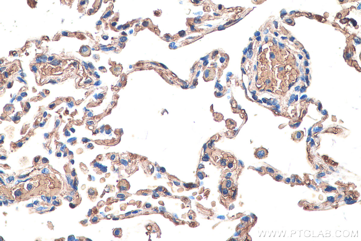 Immunohistochemical analysis of paraffin-embedded human lung tissue slide using KHC0556 (HBB IHC Kit).