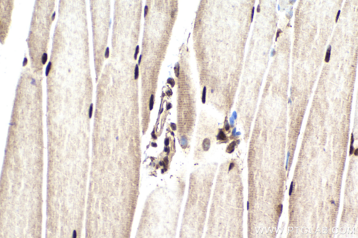 Immunohistochemical analysis of paraffin-embedded mouse skeletal muscle tissue slide using KHC1853 (HDAC2 IHC Kit).