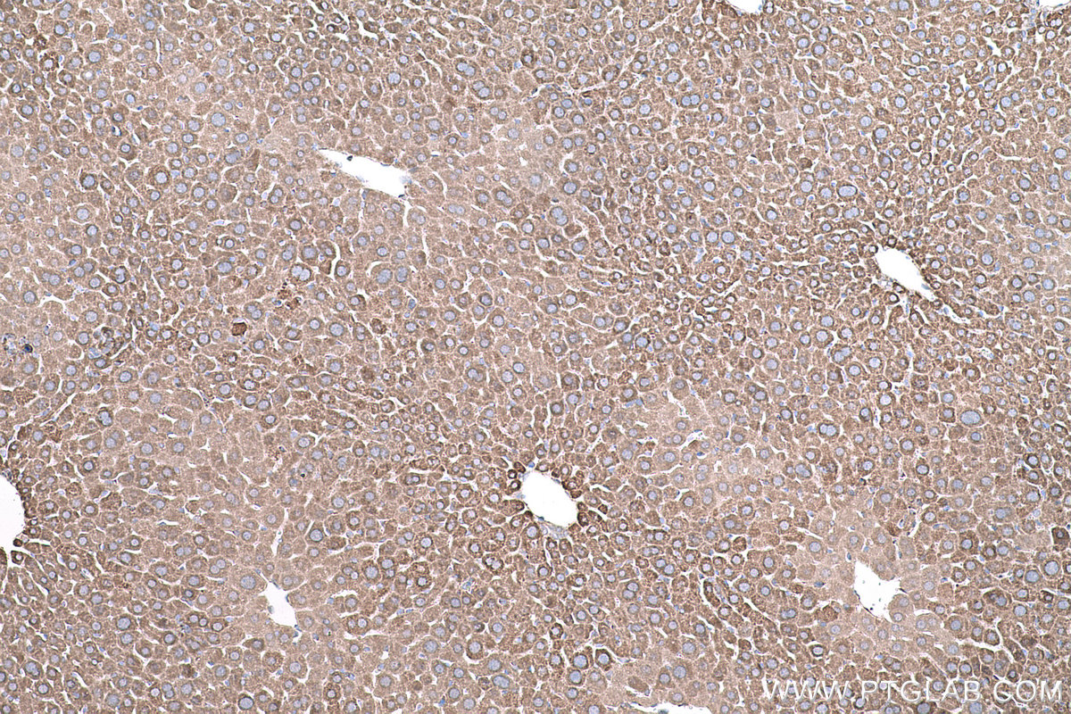 Immunohistochemical analysis of paraffin-embedded mouse liver tissue slide using KHC0615 (HDAC5 IHC Kit).