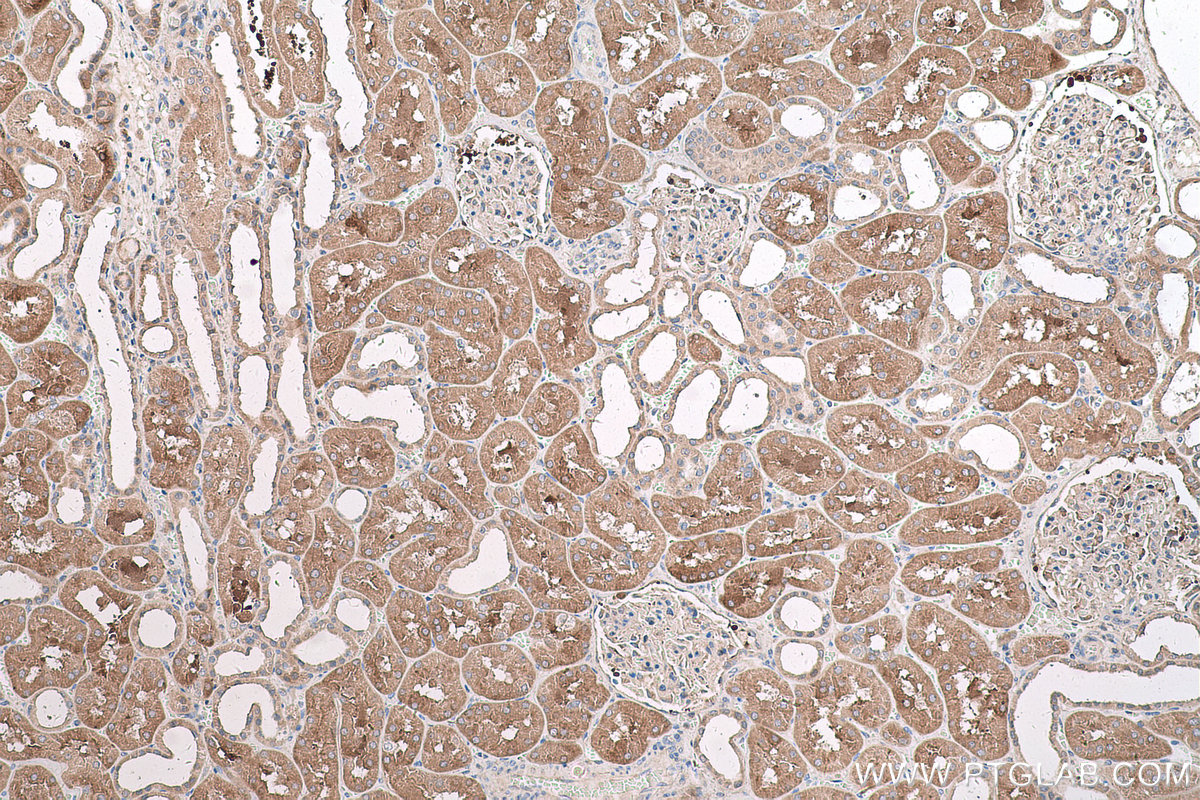 Immunohistochemical analysis of paraffin-embedded human kidney tissue slide using KHC0616 (HDAC6 IHC Kit).