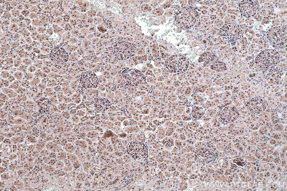 Immunohistochemical analysis of paraffin-embedded rat kidney tissue slide using KHC0617 (HDAC8 IHC Kit).