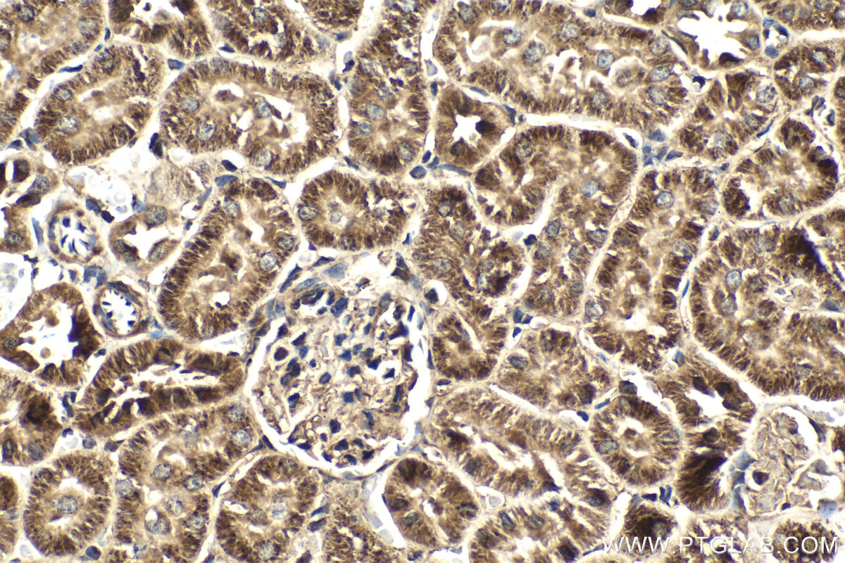 Immunohistochemical analysis of paraffin-embedded rat kidney tissue slide using KHC2036 (HDDC2 IHC Kit).