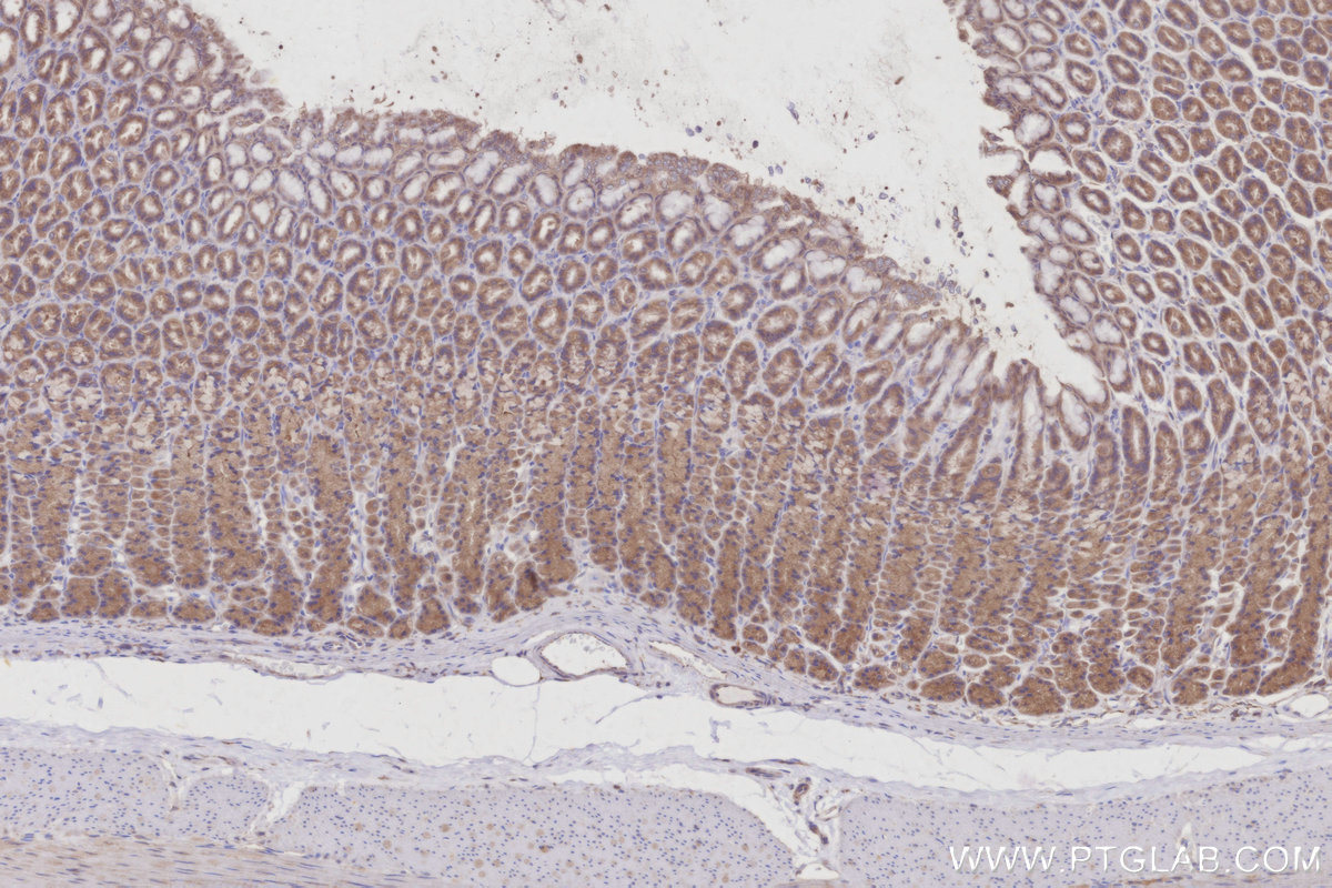 Immunohistochemical analysis of paraffin-embedded rat stomach tissue slide using KHC2992 (HEATR5B IHC Kit).