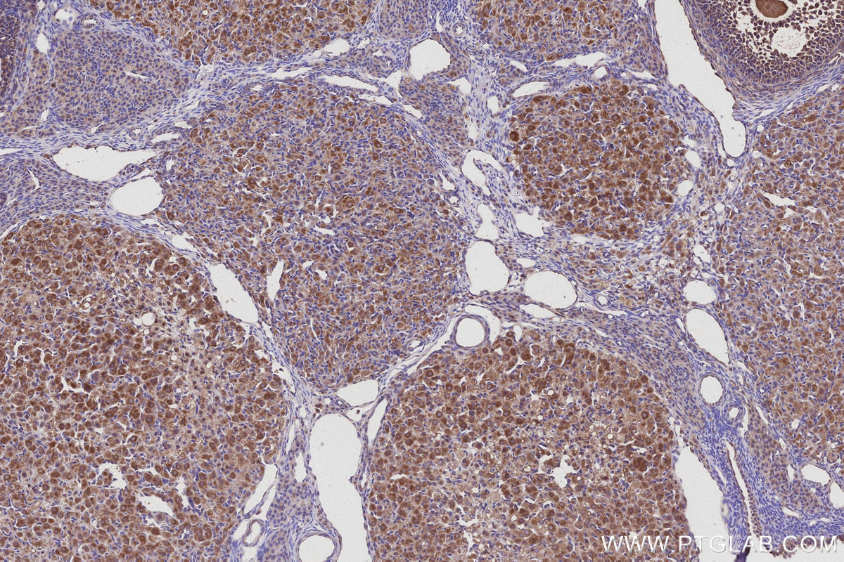 Immunohistochemical analysis of paraffin-embedded rat ovary tissue slide using KHC2992 (HEATR5B IHC Kit).