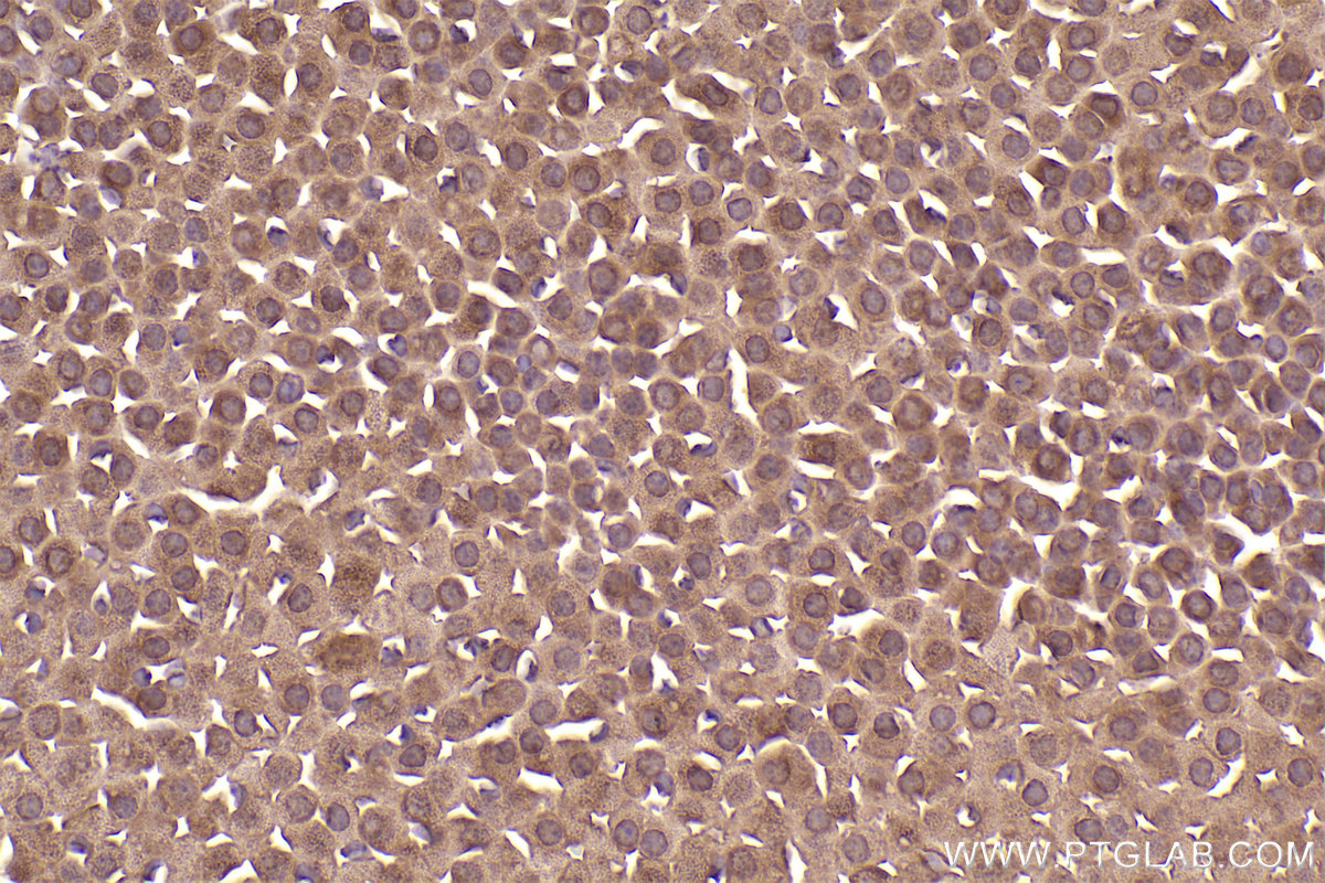 Immunohistochemical analysis of paraffin-embedded mouse adrenal gland tissue slide using KHC2553 (HECTD3 IHC Kit).