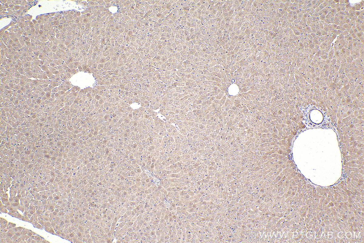 Immunohistochemical analysis of paraffin-embedded mouse liver tissue slide using KHC2473 (HEPACAM IHC Kit).