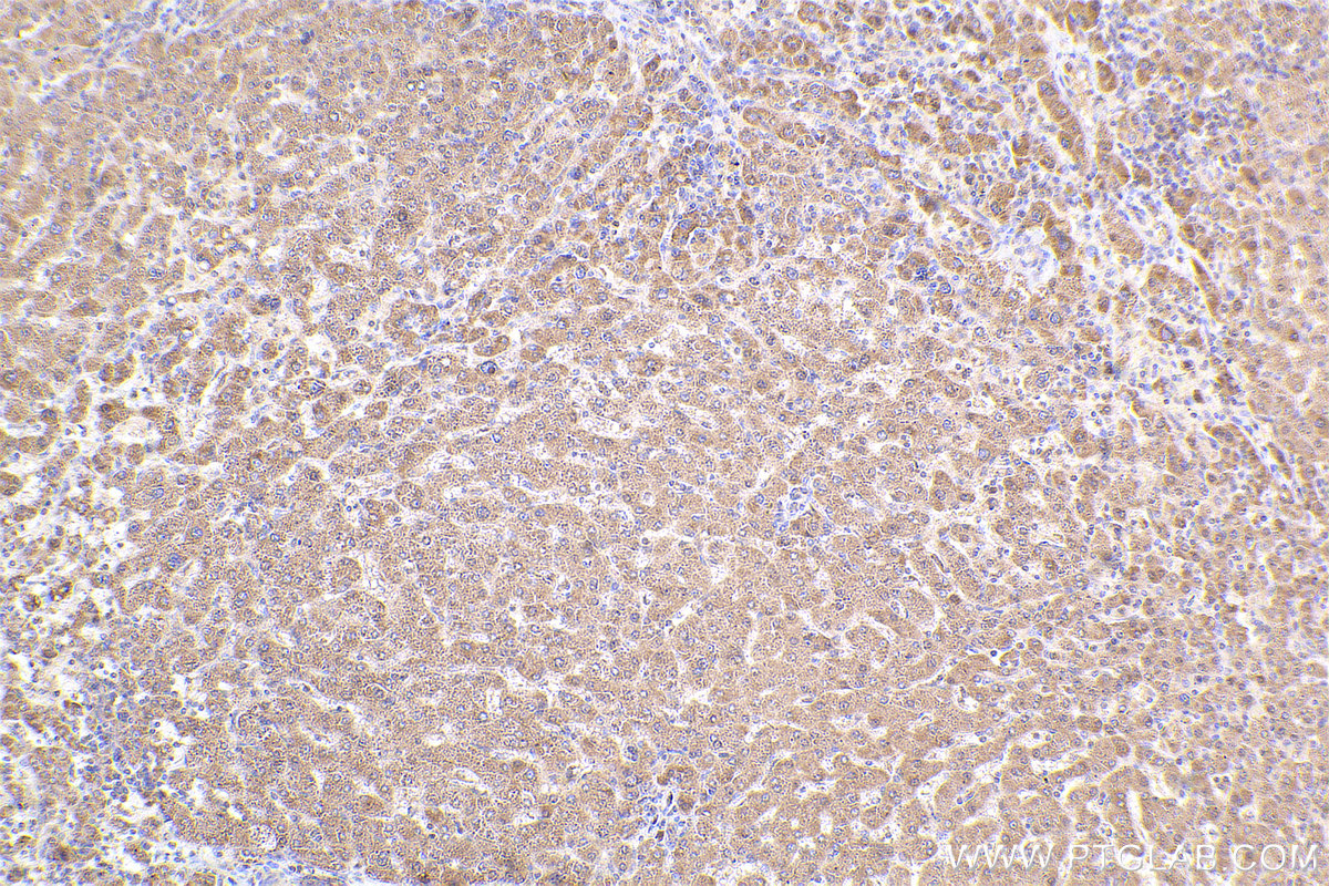 Immunohistochemical analysis of paraffin-embedded human liver tissue slide using KHC2473 (HEPACAM IHC Kit).