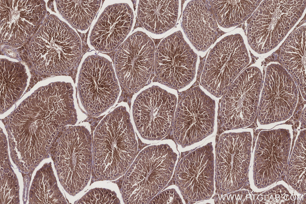 Immunohistochemical analysis of paraffin-embedded rat testis tissue slide using KHC3261 (HERC4 IHC Kit). Immunohistochemical analysis of paraffin-embedded rat testis tissue slide using KHC3261 (HERC4 IHC Kit).
