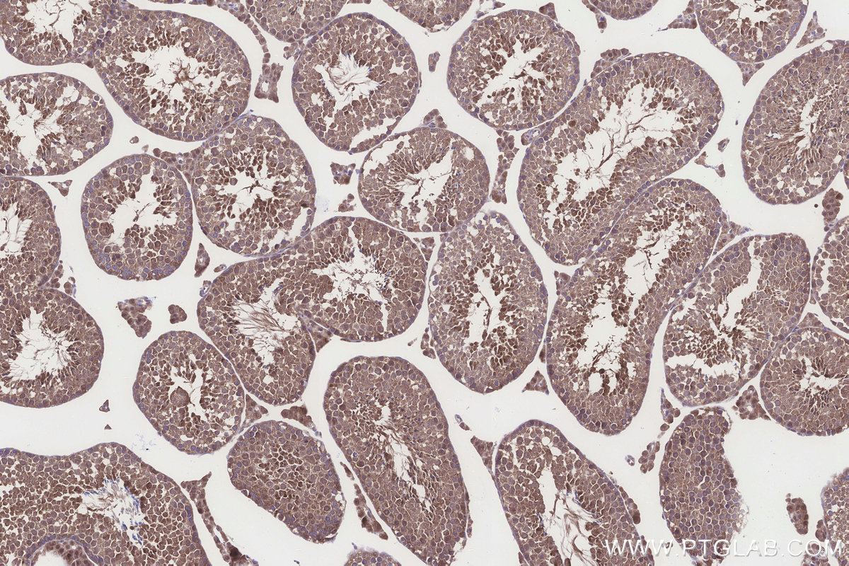 Immunohistochemical analysis of paraffin-embedded mouse testis tissue slide using KHC3261 (HERC4 IHC Kit). Immunohistochemical analysis of paraffin-embedded mouse testis tissue slide using KHC3261 (HERC4 IHC Kit).