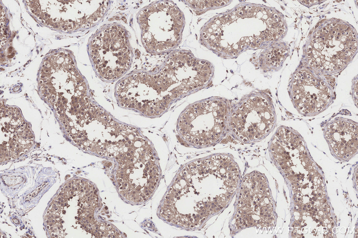 Immunohistochemical analysis of paraffin-embedded human testis tissue slide using KHC3261 (HERC4 IHC Kit). Immunohistochemical analysis of paraffin-embedded human testis tissue slide using KHC3261 (HERC4 IHC Kit).