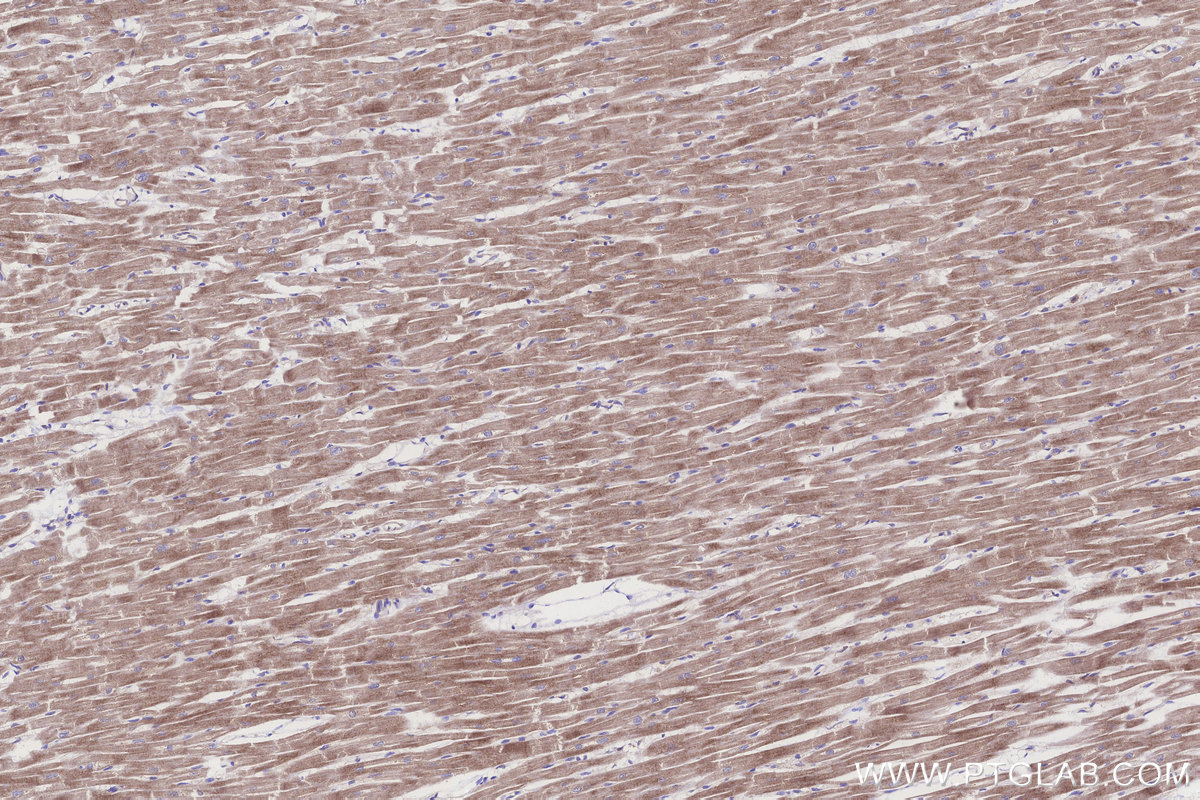 Immunohistochemical analysis of paraffin-embedded human heart tissue slide using KHC3261 (HERC4 IHC Kit). Immunohistochemical analysis of paraffin-embedded human heart tissue slide using KHC3261 (HERC4 IHC Kit).