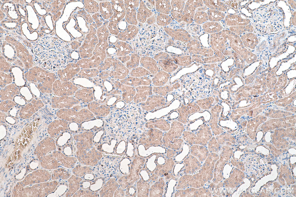 Immunohistochemical analysis of paraffin-embedded human kidney tissue slide using KHC0478 (HGF IHC Kit).