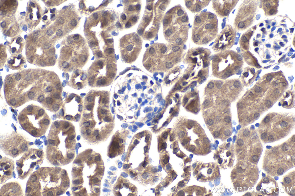 Immunohistochemical analysis of paraffin-embedded mouse kidney tissue slide using KHC1968 (HIF1AN IHC Kit).