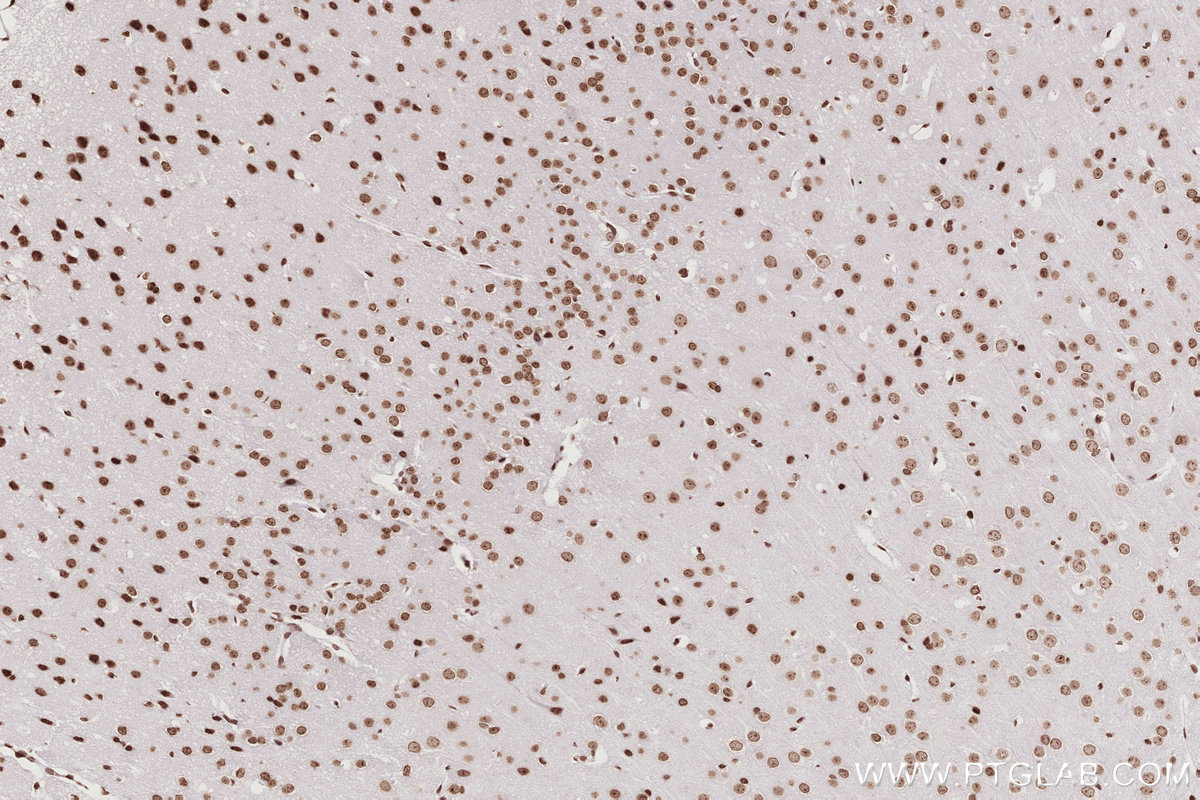 Immunohistochemical analysis of paraffin-embedded mouse brain tissue slide using KHC2771 (HIST1H2AC IHC Kit).