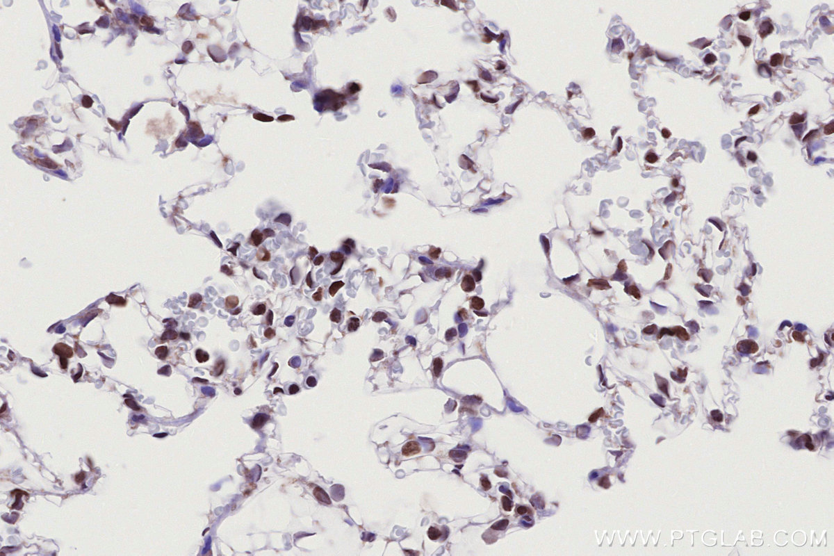Immunohistochemical analysis of paraffin-embedded rat lung tissue slide using KHC2771 (HIST1H2AC IHC Kit).