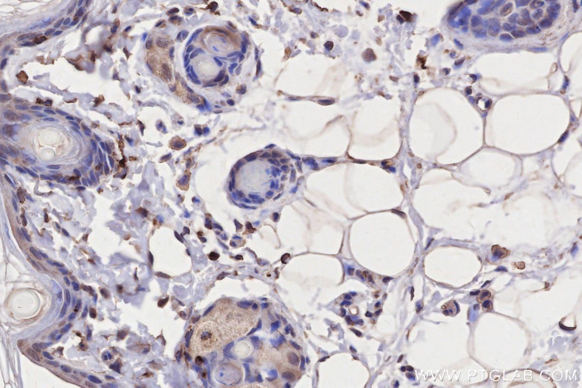 Immunohistochemical analysis of paraffin-embedded rat skin tissue slide using KHC2757 (HLA-DRA IHC Kit).