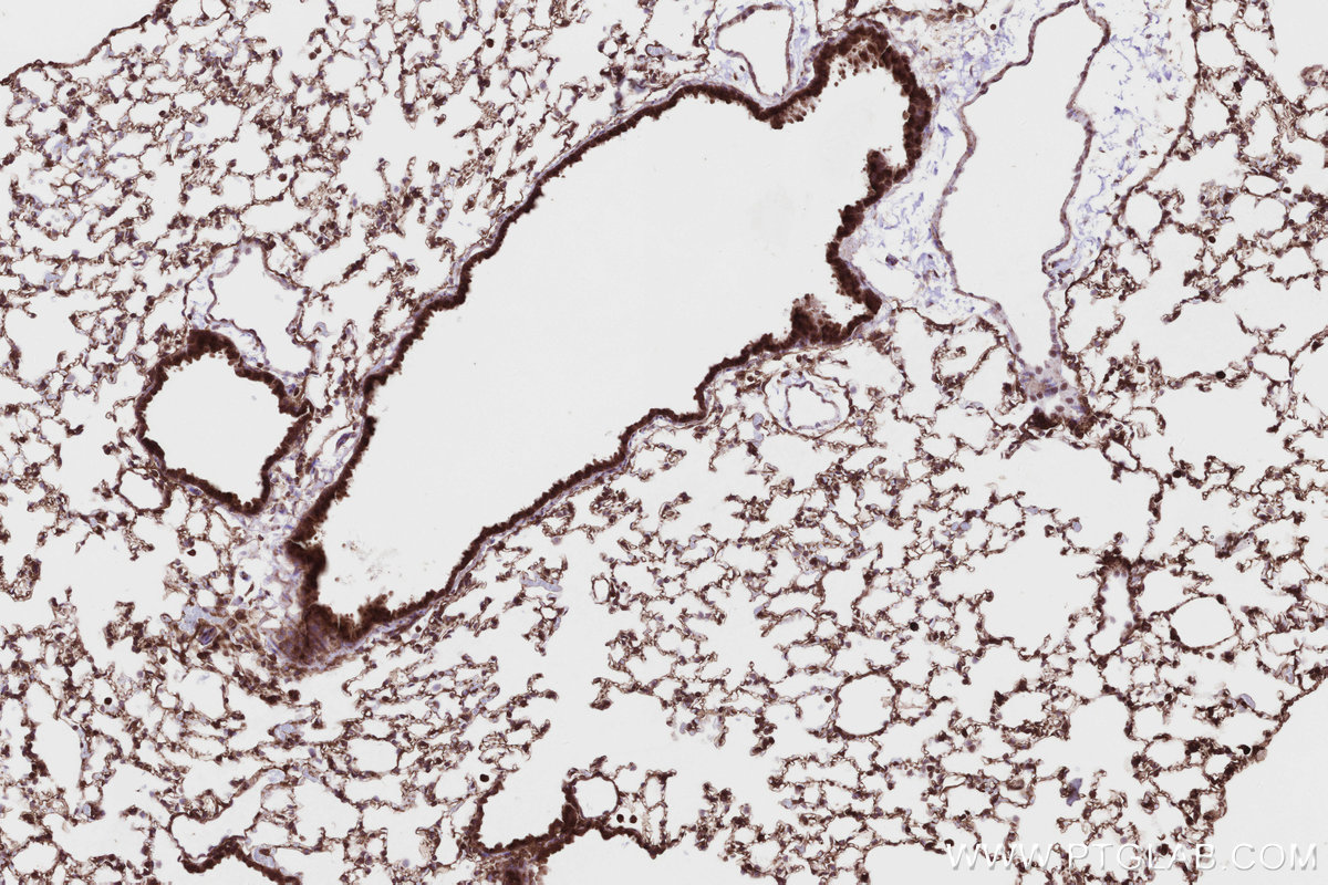 Immunohistochemical analysis of paraffin-embedded mouse lung tissue slide using KHC2831 (HMCN1 IHC Kit).
