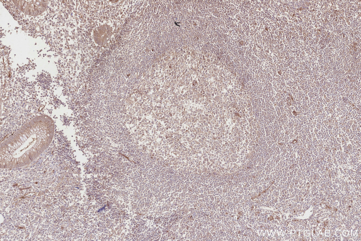 Immunohistochemical analysis of paraffin-embedded human appendicitis tissue slide using KHC2831 (HMCN1 IHC Kit).