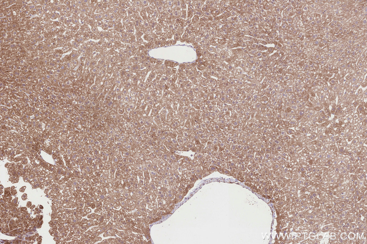 Immunohistochemical analysis of paraffin-embedded mouse liver tissue slide using KHC2831 (HMCN1 IHC Kit).