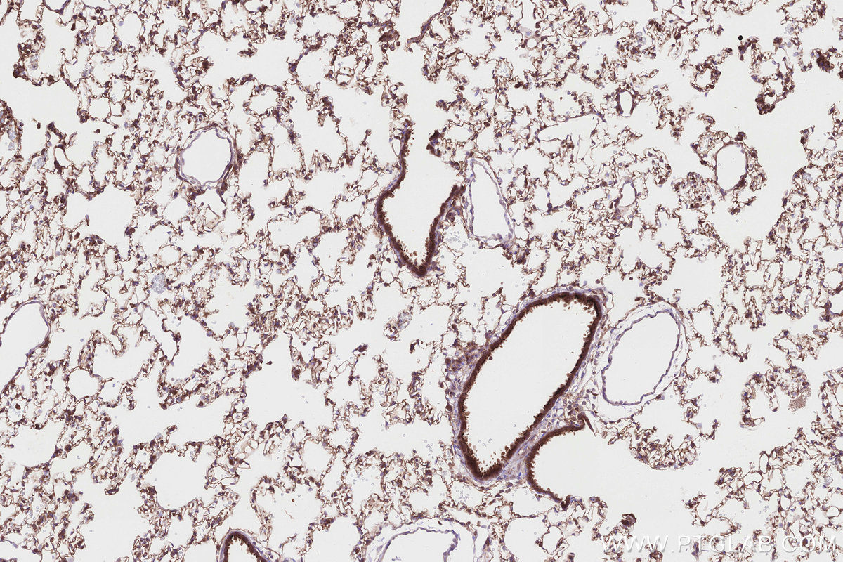 Immunohistochemical analysis of paraffin-embedded rat lung tissue slide using KHC2831 (HMCN1 IHC Kit).