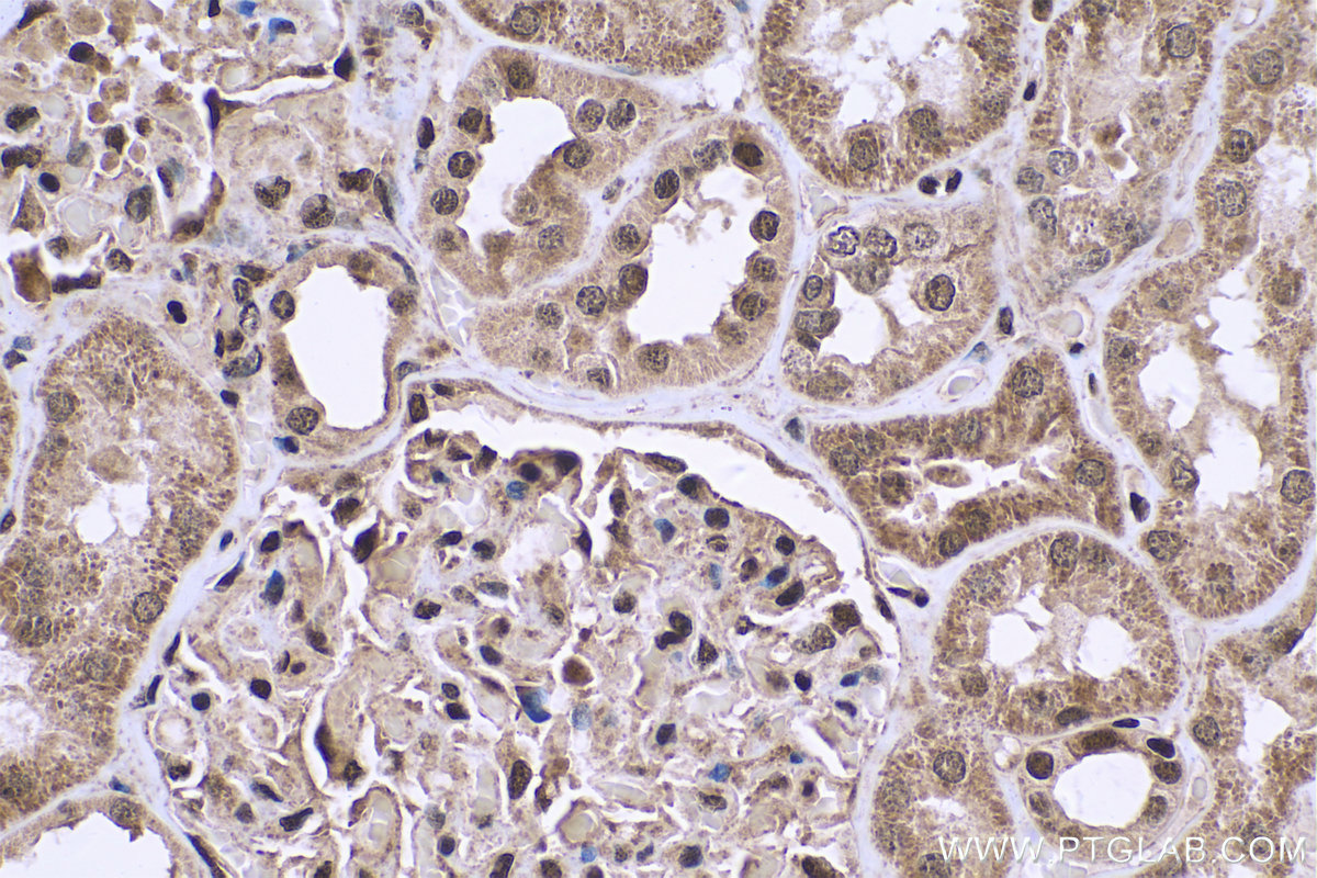 Immunohistochemical analysis of paraffin-embedded human kidney tissue slide using KHC0736 (HMGB1 IHC Kit).