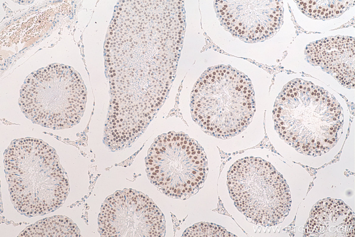 Immunohistochemical analysis of paraffin-embedded rat testis tissue slide using KHC0723 (HMGB2 IHC Kit).