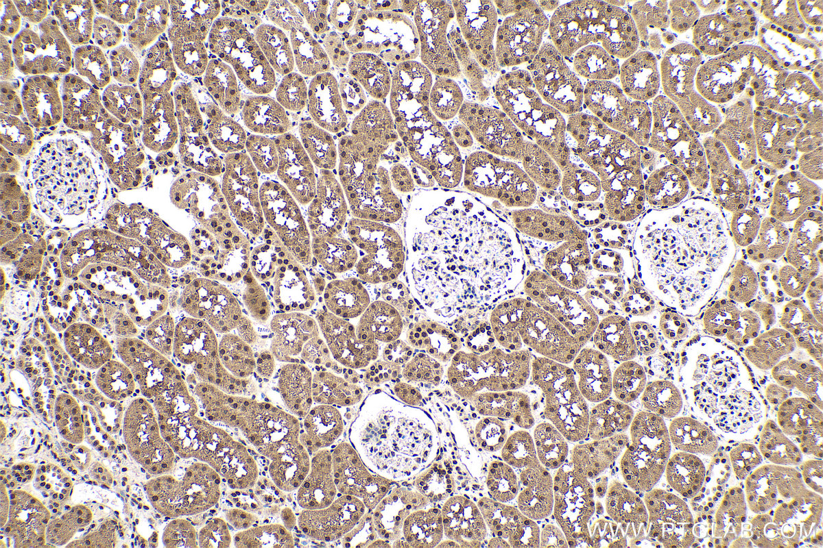 Immunohistochemical analysis of paraffin-embedded human kidney tissue slide using KHC0723 (HMGB2 IHC Kit).