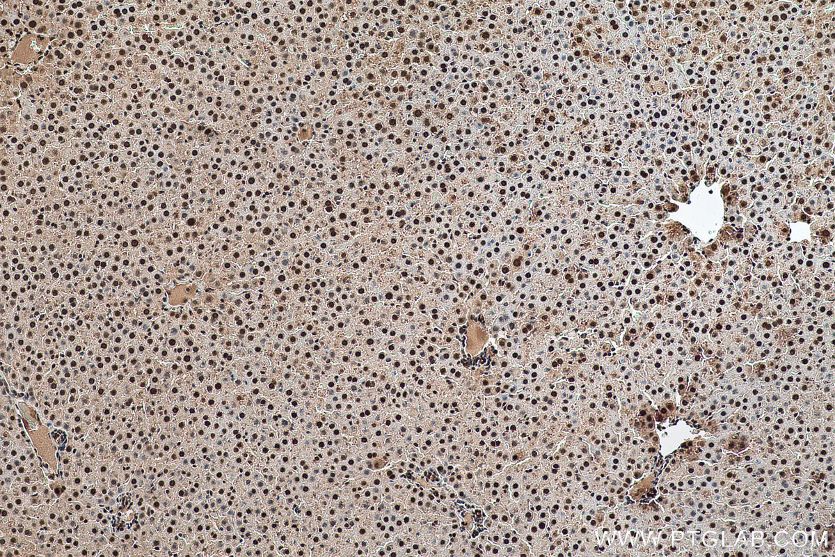 Immunohistochemical analysis of paraffin-embedded rat liver tissue slide using KHC0682 (HNRNPA1 IHC Kit).