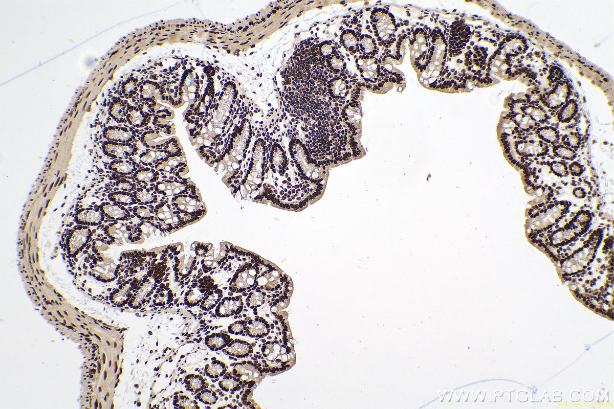 Immunohistochemical analysis of paraffin-embedded mouse colon tissue slide using KHC0657 (HNRNPA3 IHC Kit).