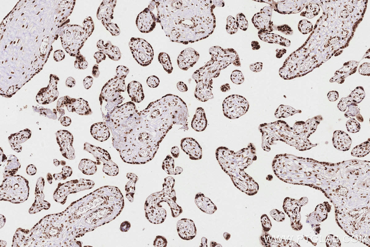 Immunohistochemical analysis of paraffin-embedded human placenta tissue slide using KHC2847 (HNRNPAB IHC Kit).