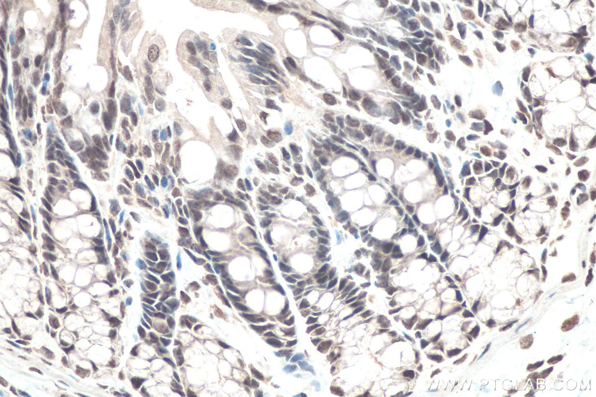 Immunohistochemical analysis of paraffin-embedded rat colon tissue slide using KHC0663 (HNRNPD IHC Kit).