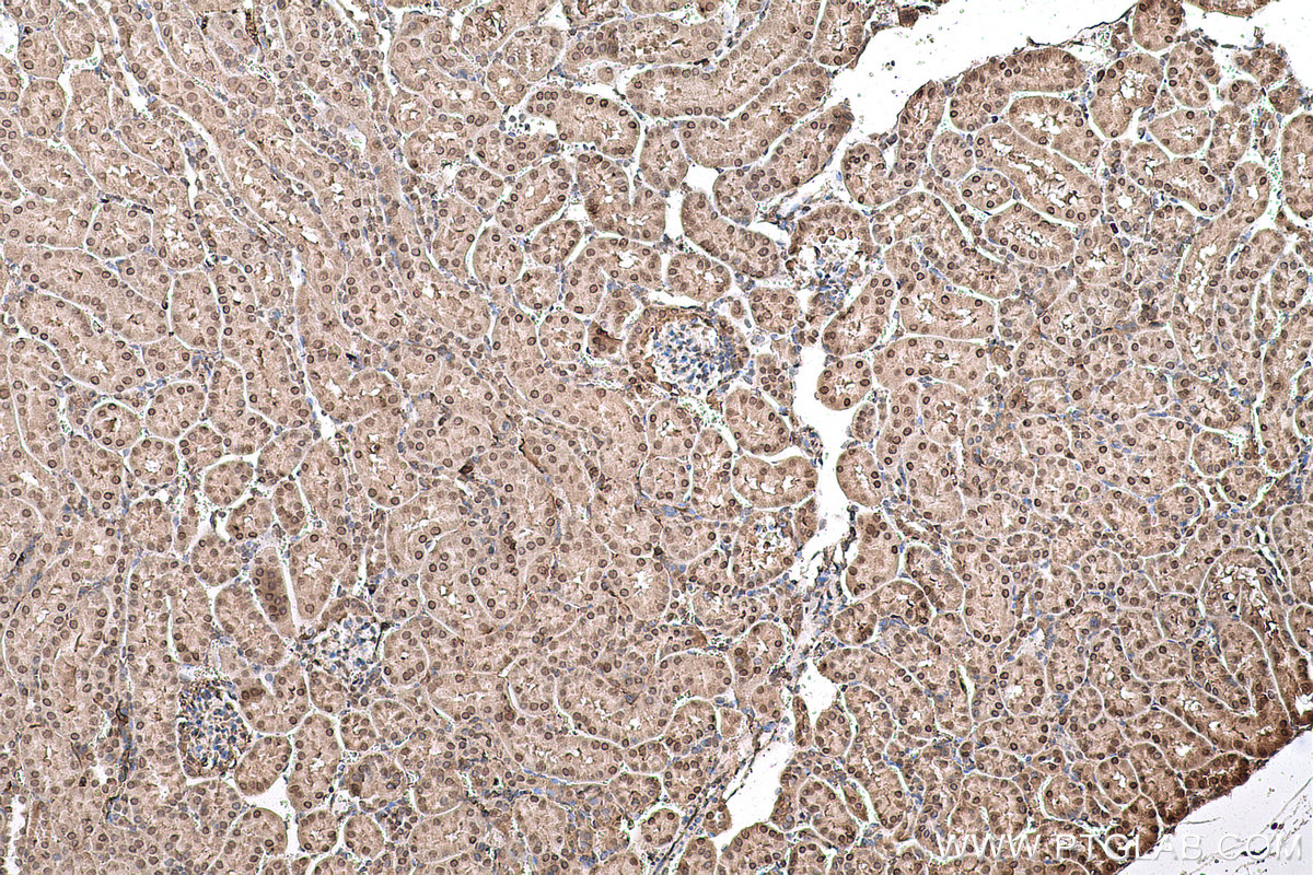 Immunohistochemical analysis of paraffin-embedded mouse kidney tissue slide using KHC0590 (HNRNPK IHC Kit).