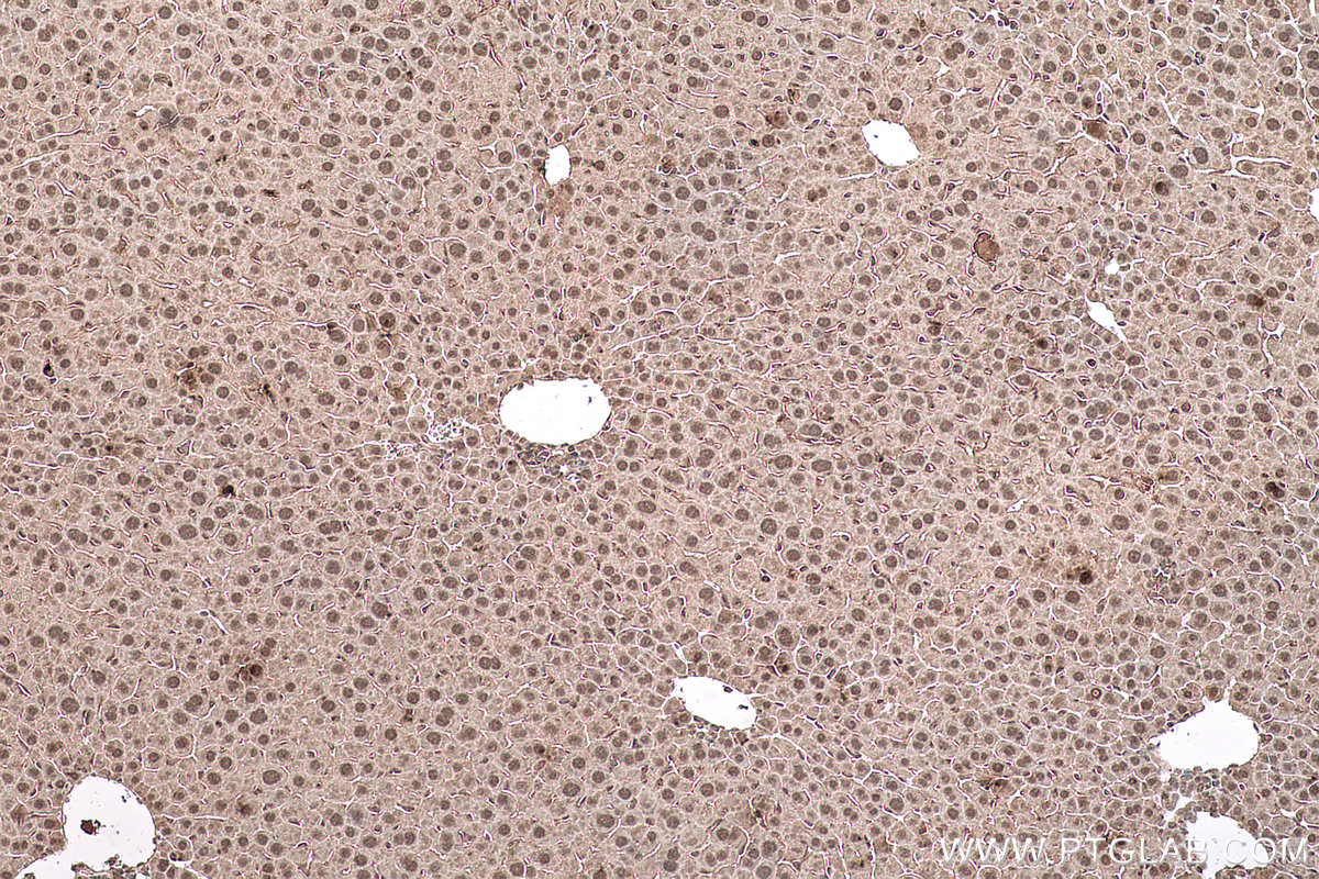 Immunohistochemical analysis of paraffin-embedded mouse liver tissue slide using KHC0590 (HNRNPK IHC Kit).