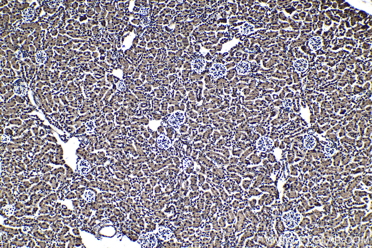 Immunohistochemical analysis of paraffin-embedded mouse kidney tissue slide using KHC1386 (HNRNPL IHC Kit).