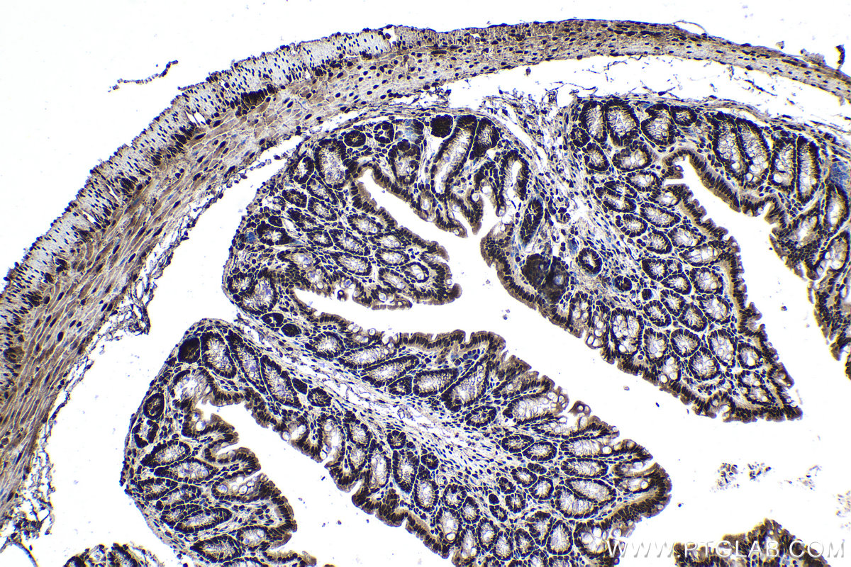 Immunohistochemical analysis of paraffin-embedded mouse colon tissue slide using KHC1386 (HNRNPL IHC Kit).